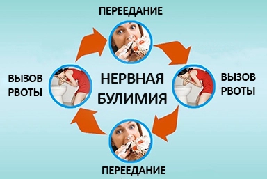Лечение булимии в Межводном